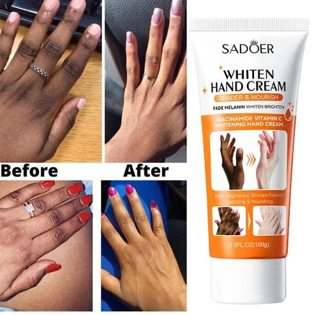 Whiten Hand Cream (100g)